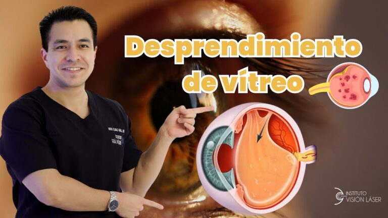 se puede trabajar con desprendimiento de vítreo